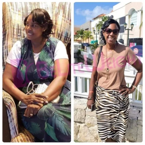 Weight Loss Surgery Before and After Deborah B - 13 Month Update*